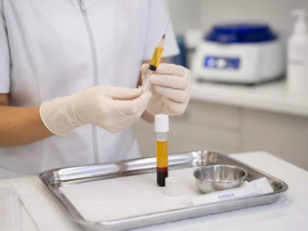 PRP blood draw